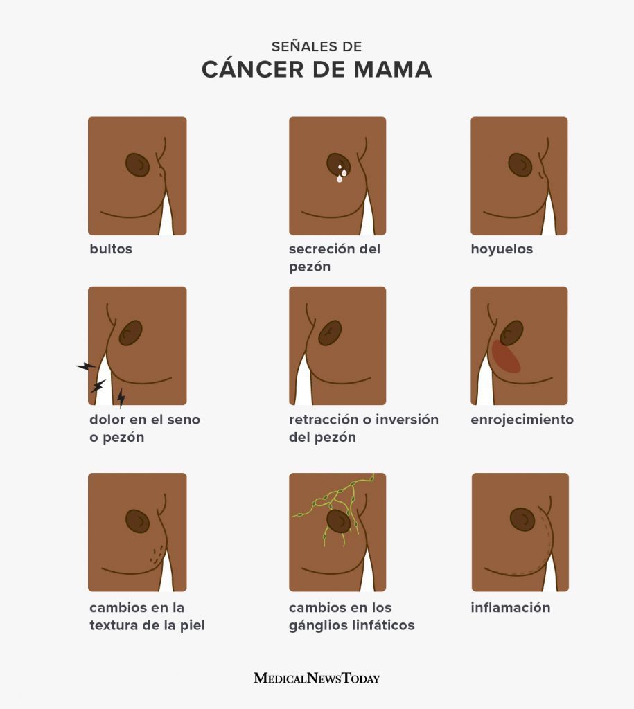 3319 Breast Cancer Symptoms Spanish 1296x728 Body 20210323201926057