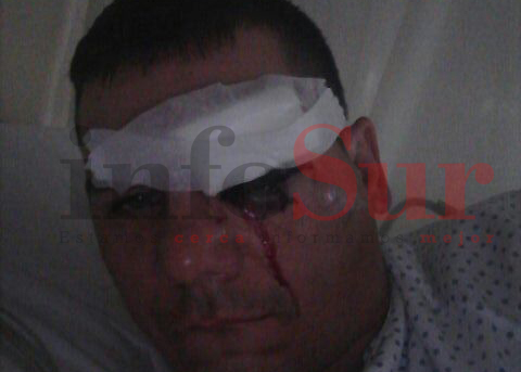 Claypole: agreden a  un obrero ferroviario porque suspendieron el tren