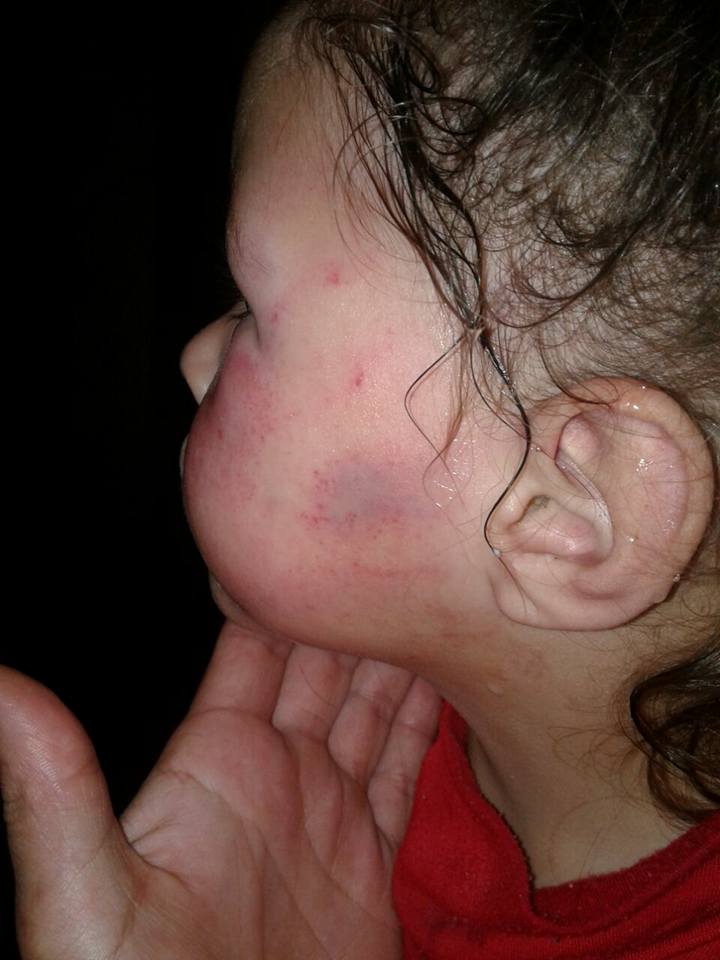 La Plata: le dio una paliza a su hijastra y la maquilló para ocultar los moretones