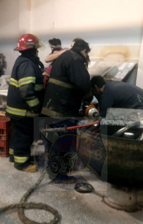 Trabajaba en una panaderia y su brazo quedó atrapado por una sobadera