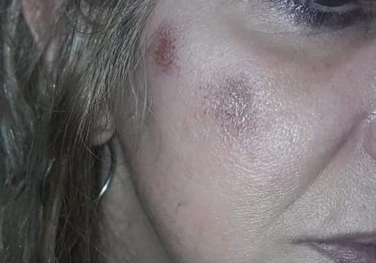 Adrogué: denuncia que su vecino la golpeó, la espía y amenaza con matarle a los perros
