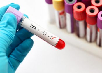Aprueban una nueva terapia contra el cáncer de próstata
