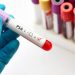 Aprueban una nueva terapia contra el cáncer de próstata