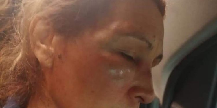 Rivadavia: golpearon a una jubilada y apuntaron con un arma a un bebé