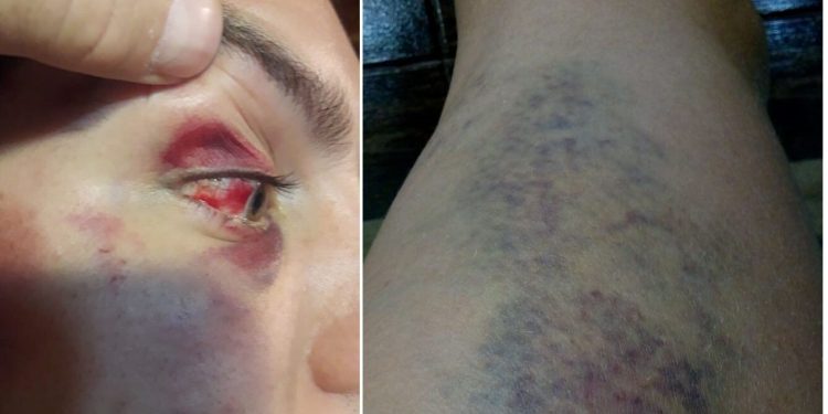 Longchamps: denuncian abuso policial a la salida de un boliche y piden testigos del hecho