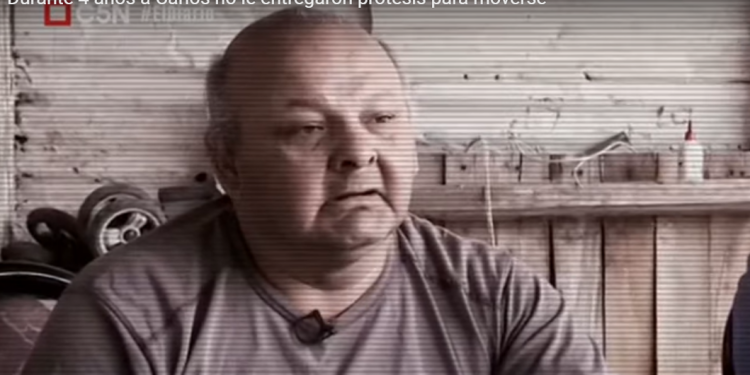 Después de cuatro años, Carlos volvió a tener sus prótesis nuevas