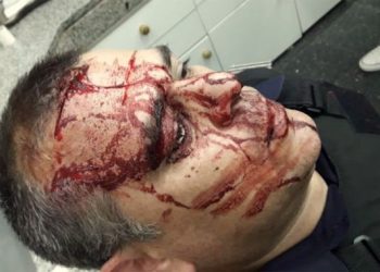 Berazategui: detienen a un policía que mató a un joven con un balazo de goma