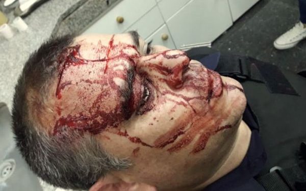 Berazategui: detienen a un policía que mató a un joven con un balazo de goma