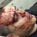 Berazategui: detienen a un policía que mató a un joven con un balazo de goma