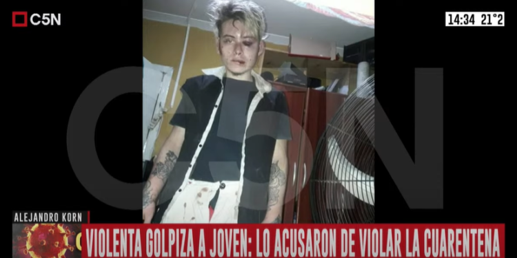 Korn: tres policías desfiguraron a un joven en un control por la cuarentena