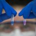 Cómo funcionan los nuevos test argentinos para detectar el COVID-19