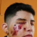Pedirán prisión preventiva para policía que dejó ciego a un adolescente en un allanamiento