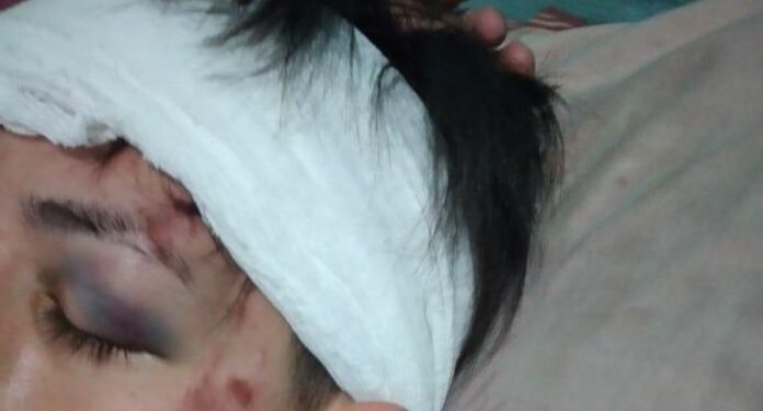 Solano: un joven fue brutalmente golpeado por cuatro hombres que le robaron su celular