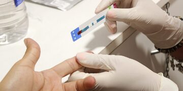 En el Día Mundial del Sida, testeos de HIV en las localidades de Brown
