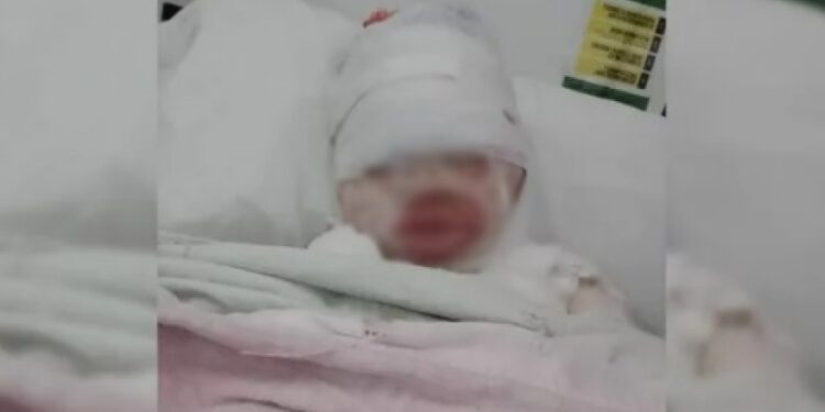 Varela: le tiraron aceite hirviendo a una nena de 3 años y está internada