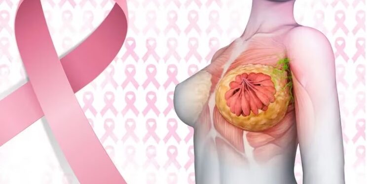 Día Mundial del Cáncer de Mama: 10 respuestas clave para prevenir y tratar