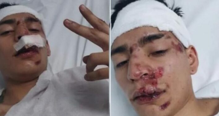 Longchamps: brutal golpiza en patota a un joven para robarle a la salida del boliche