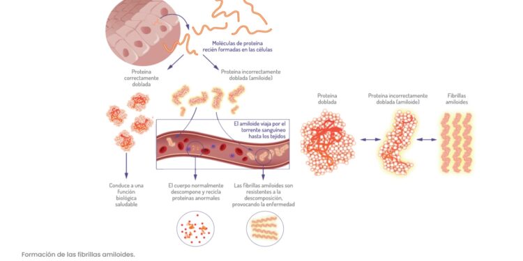 Enfermedades Poco Frecuentes: hay más de 8 mil y afectan a 3,6 millones de personas en Argentina
