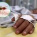 Se confirmaron 36.000 nuevos casos de dengue y 36 muertos en la última semana