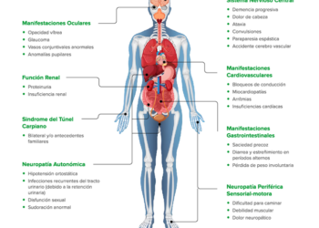 ¿Qué es la Amiloidosis Hereditaria por Transtiretina?