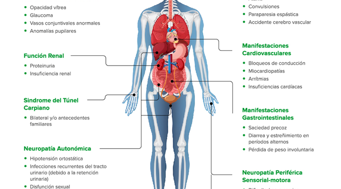 ¿Qué es la Amiloidosis Hereditaria por Transtiretina?
