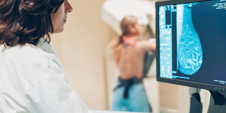 Cáncer de mama: “Es fundamental el control preventivo”