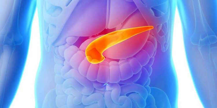 Día del Síndrome de Quilomicronemia Familiar: cómo prevenir la enfermedad poco frecuente que causa pancreatitis