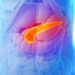 Día del Síndrome de Quilomicronemia Familiar: cómo prevenir la enfermedad poco frecuente que causa pancreatitis