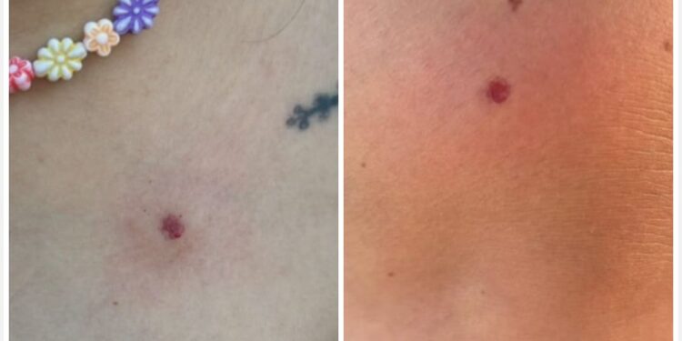 Adrogué: balearon a artistas que ensayaban en una plaza