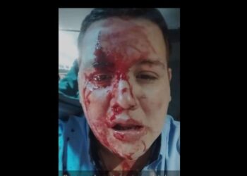 Agredieron a un chofer de La Costera y paran el 338 y el 406