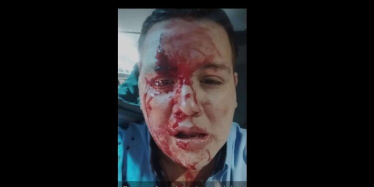 Agredieron a un chofer de La Costera y paran el 338 y el 406