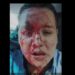Agredieron a un chofer de La Costera y paran el 338 y el 406