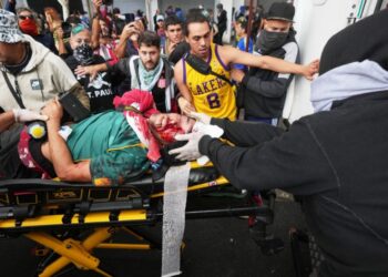 Está «muy grave» el fotógrafo de Lanús al que la policía le disparó en la cabeza durante la feroz represión