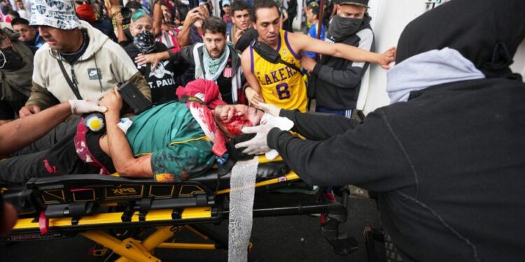 Está «muy grave» el fotógrafo de Lanús al que la policía le disparó en la cabeza durante la feroz represión