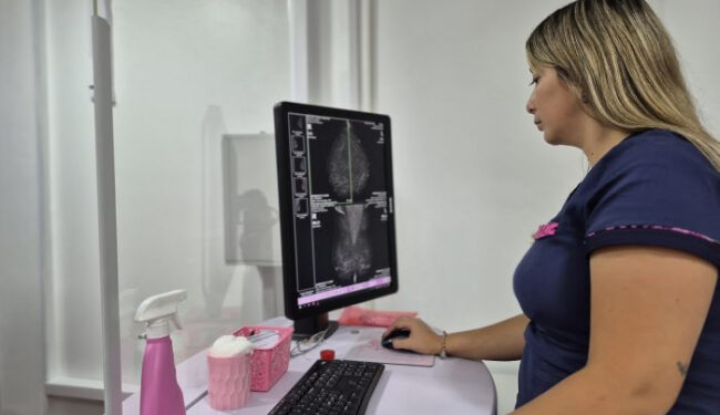 Calzada: el hospital Oñativia sumó un nuevo mamógrafo de última generación