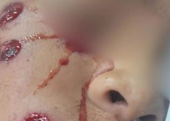 Denuncian que la policía bonaerense baleó en el rostro a un niño en un operativo en Quilmes y separan a un agente de la fuerza