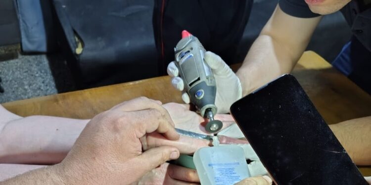 A una vecina de Longchamps se le trabó el anillo y tuvo que llamar a los Bomberos