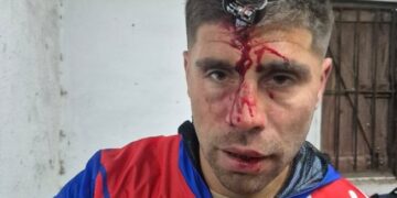 A un ex jugador de Claypole le clavaron una llave de auto en la cabeza durante un torneo de fútbol femenino