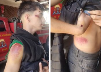 Longchamps: tres ladrones golpearon brutalmente y le robaron la bicicleta a un bombero cuando iba a apagar un incendio