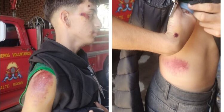 Longchamps: tres ladrones golpearon brutalmente y le robaron la bicicleta a un bombero cuando iba a apagar un incendio