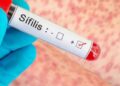 Argentina registra un pico de casos de sífilis: qué es la infección y cómo prevenirla