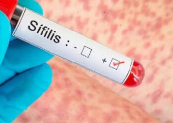 Argentina registra un pico de casos de sífilis: qué es la infección y cómo prevenirla