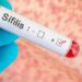 Argentina registra un pico de casos de sífilis: qué es la infección y cómo prevenirla