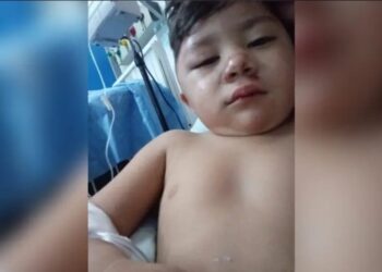 San José: buscan a un conductor que atropelló a un niño de 2 años y escapó