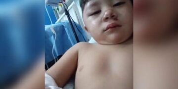 San José: buscan a un conductor que atropelló a un niño de 2 años y escapó